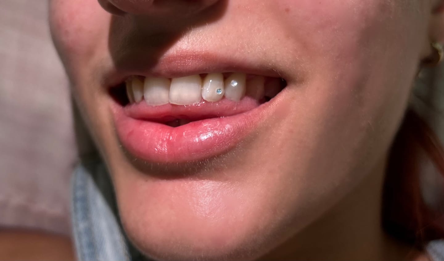 Customer photo review of Gemas Dentales Preciosa - Crystal