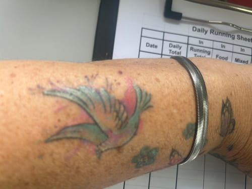 Customer photo review of TattooNumbx Numbing Cream