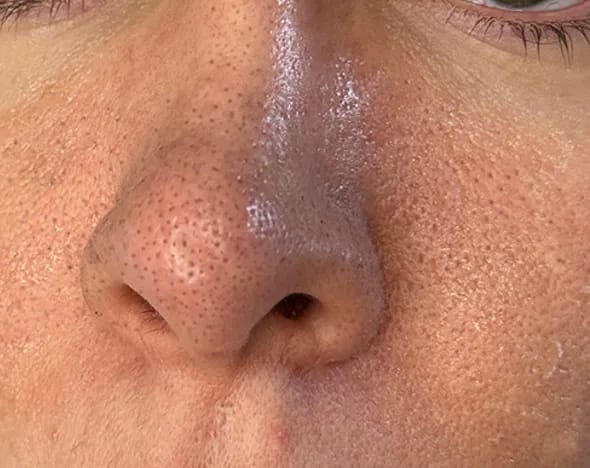 Customer photo review of Peel Shot Serum - ByLorai