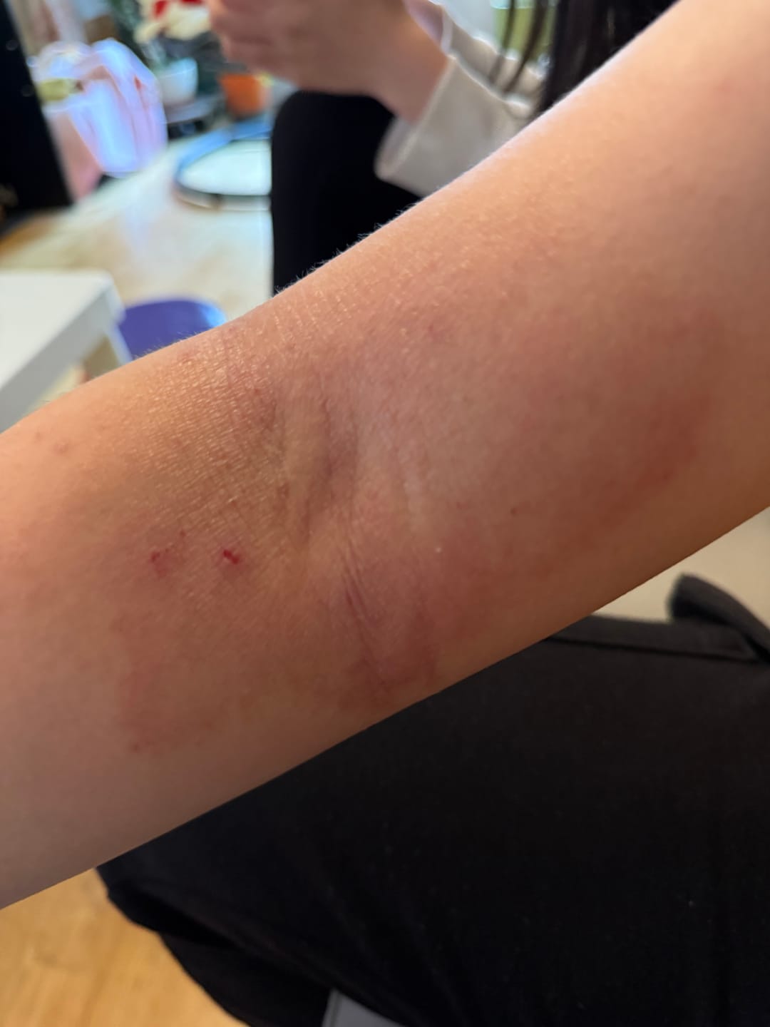 Customer photo review of Bioskin Zeoderm Skin Repair Moisturiser
