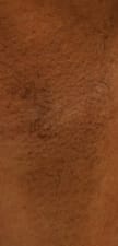 Customer photo review of Smoothskin IPL Pure Fit V2