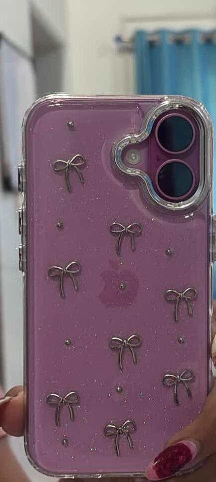 Customer photo review of 3D Glitter Silver Bow Transparent iPhone Case