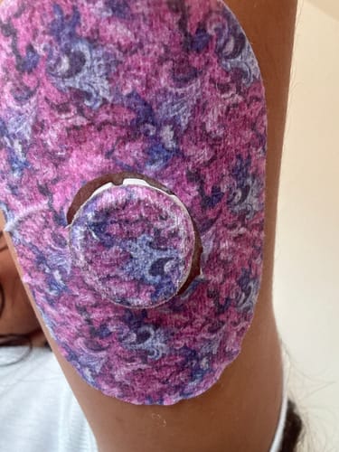 Customer photo review of Dexcom G7 Sensor Patches - Patch Me UP! Spring