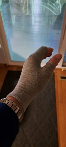 Customer photo review of Premium Onecompress™ Gloves