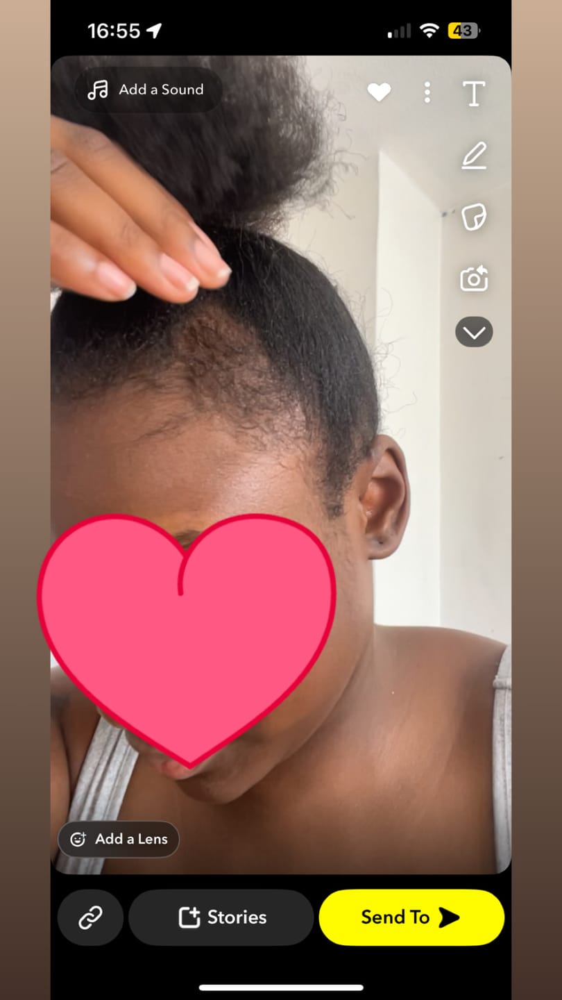 Customer photo review of 100% Natural Hair Growth / Thickening Oil