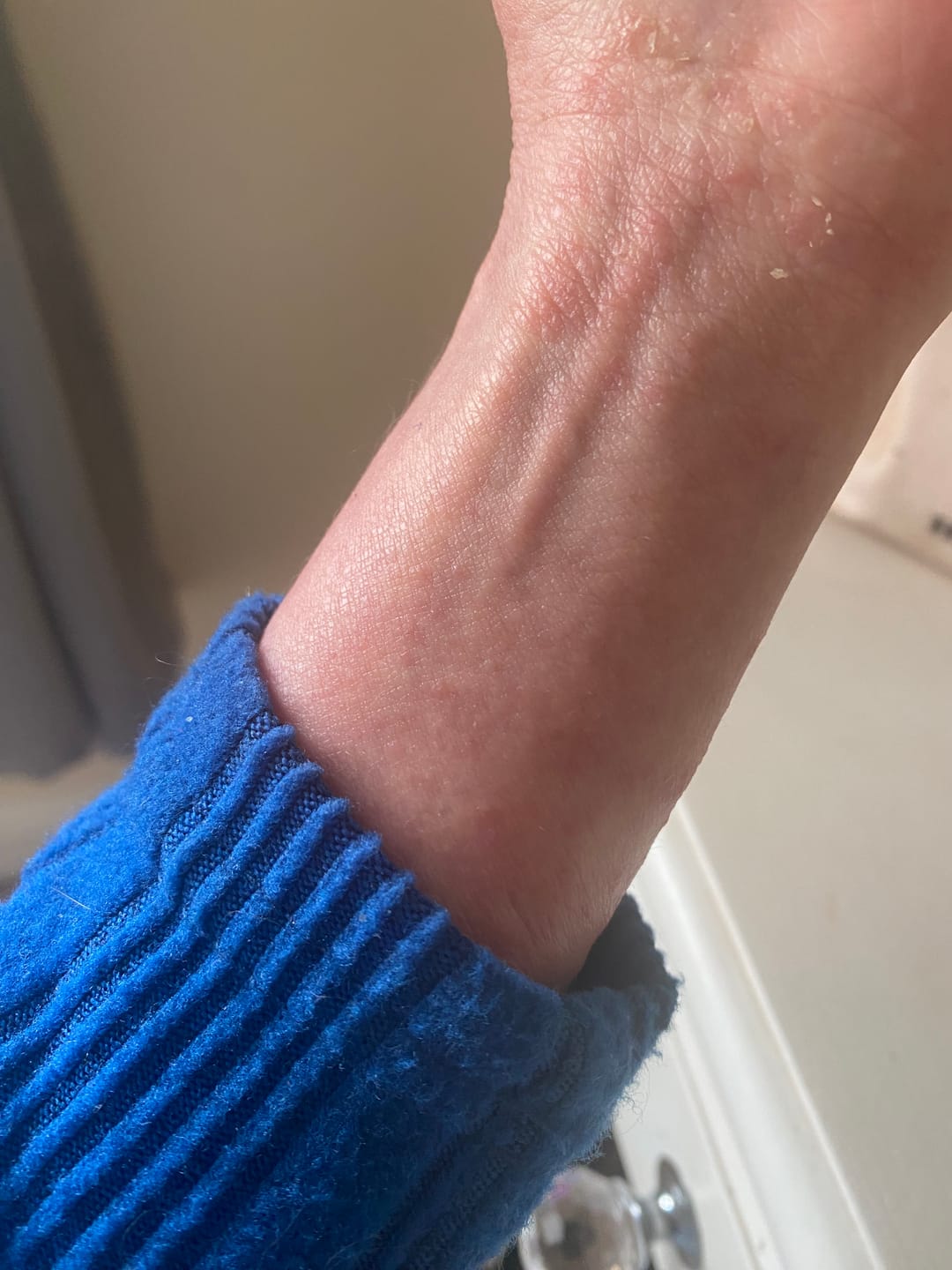 Customer photo review of Prebiotic Hand Cream