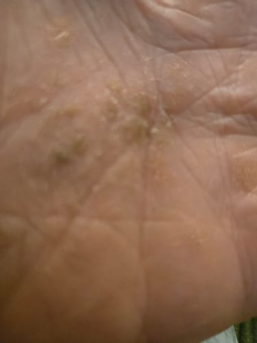 Customer photo review of F-Balm - Premium Anti-aging Tallow Balm - 2 oz.