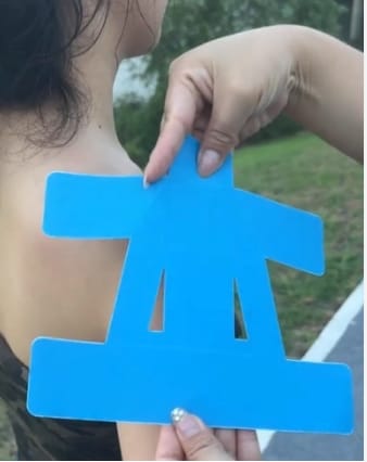 Kundenbewertung mit Foto zu TAPEX™ - Schultergelenk