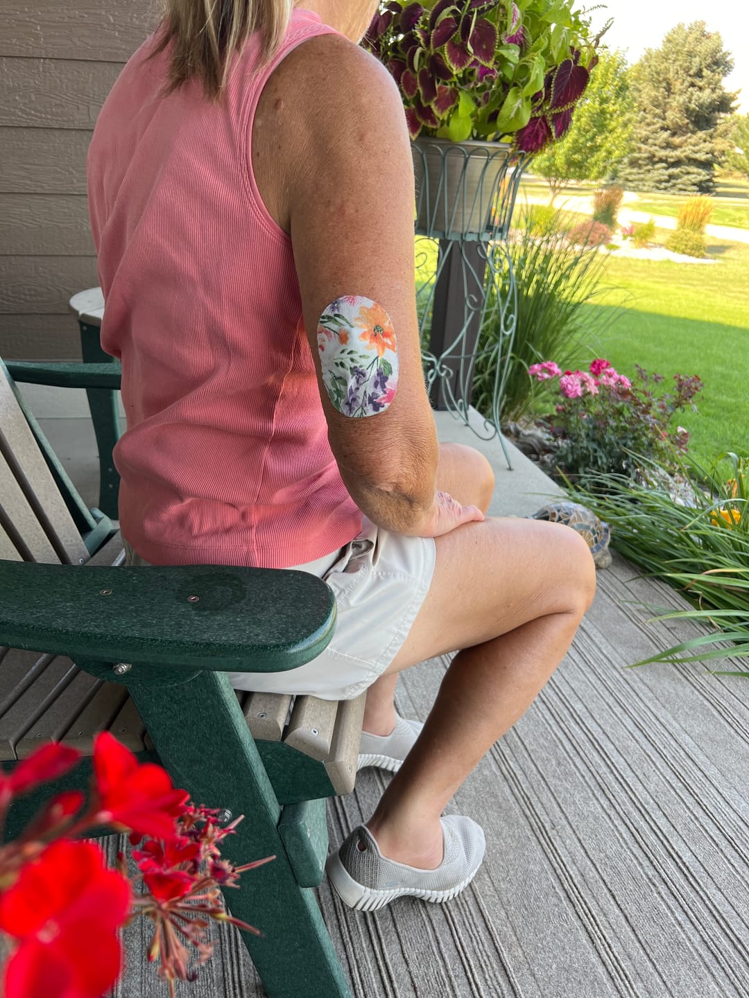 Customer photo review of Skin Grip Original - Medtronic Guardian/Enlite Adhesive Patches
