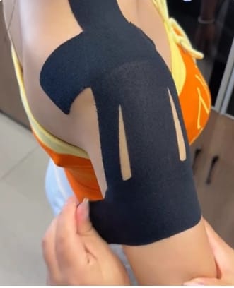 Kundenbewertung mit Foto zu TAPEX™ - Schultergelenk