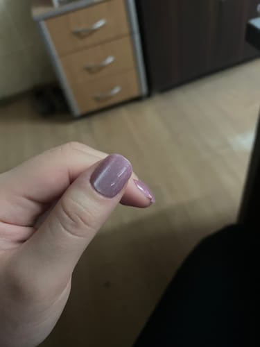 Customer photo review of Starlight Kiss - XS Squoval - 30 Adet Takma Tırnak