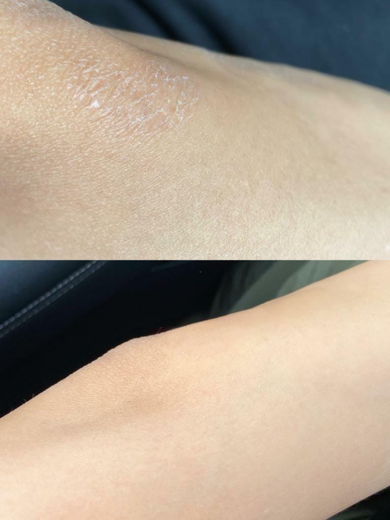 Customer photo review of Ready Set Glow - The Deliciously Effective Beauty Gummy