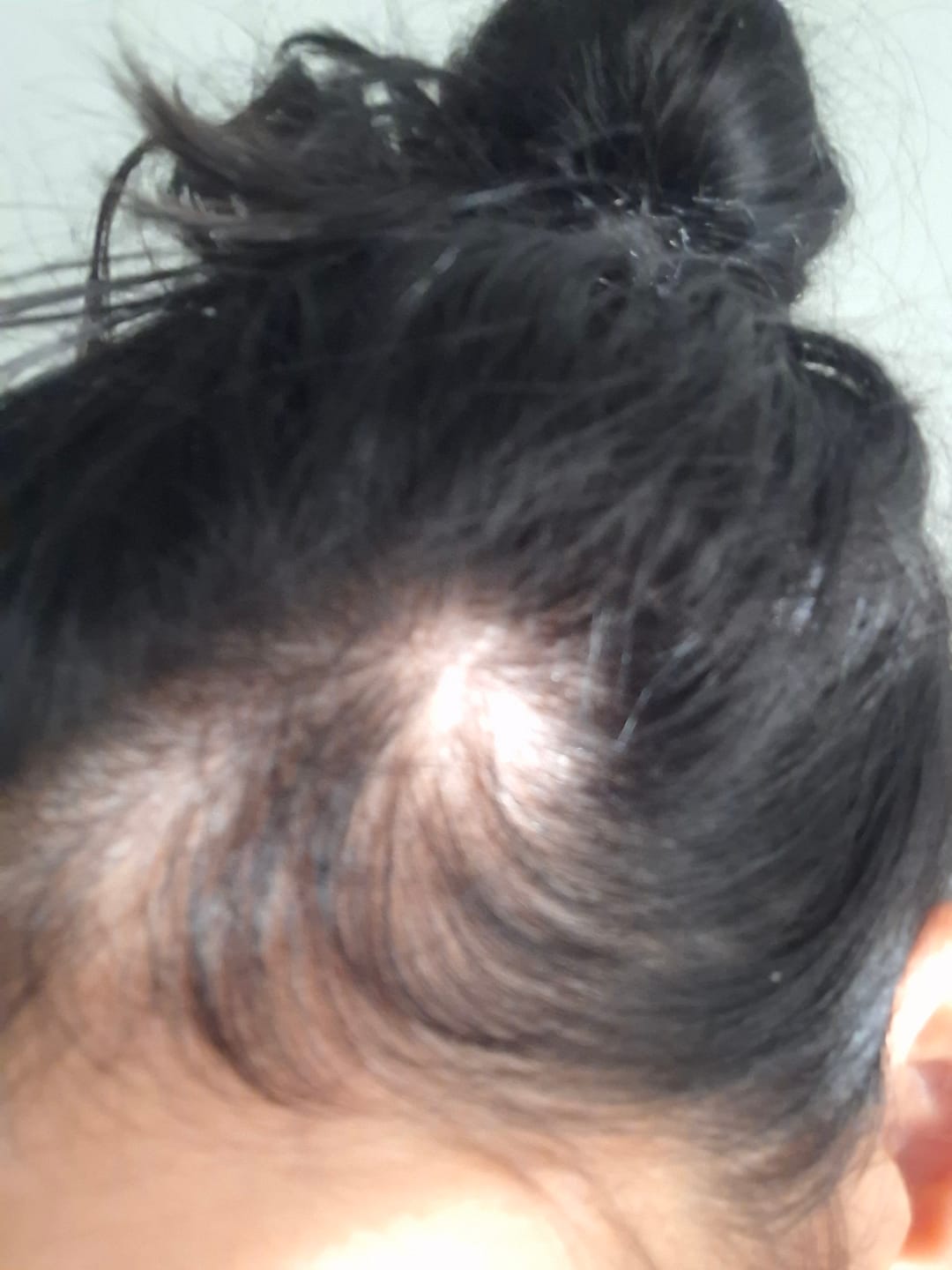 Customer photo review of Sérum de croissance pour cheveux (3 mois)