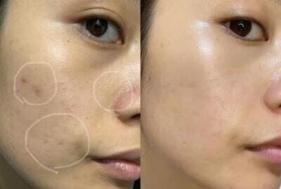 Customer photo review of Ready Set Glow - The Deliciously Effective Beauty Gummy