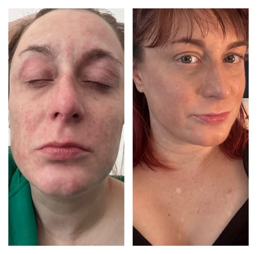 Customer photo review of Sea Cucumber Collagen Calming Cream