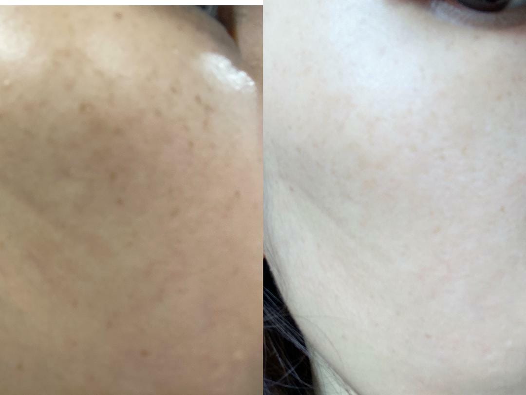 Customer photo review of Ready Set Glow - The Deliciously Effective Beauty Gummy