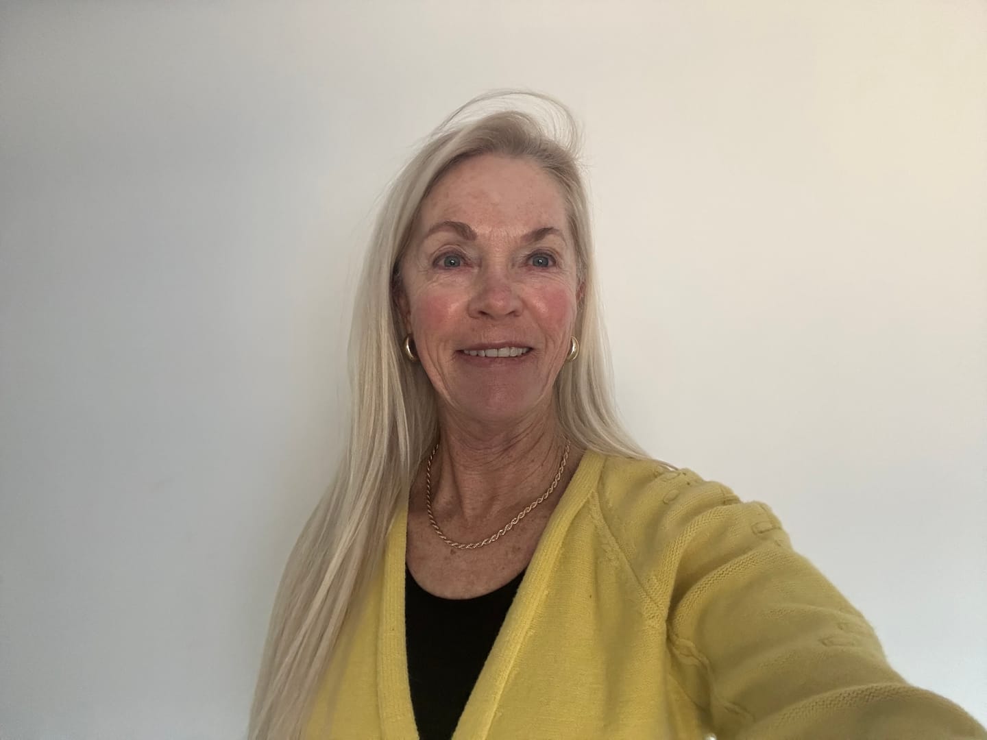 Customer photo review of Buy a Revitalizing Vitamin C Face Cream, Get a Free Vitamin C Serum