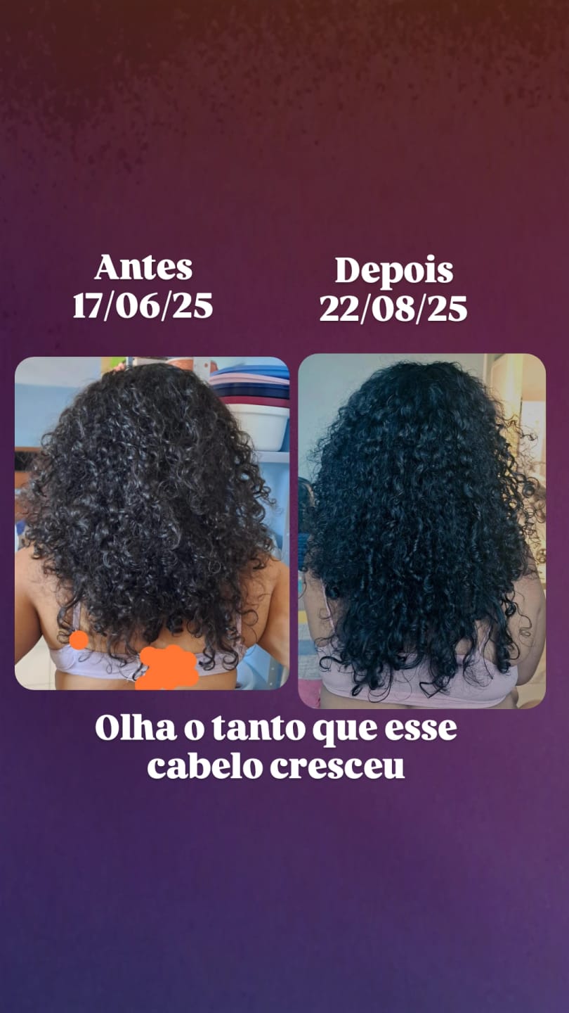 Customer photo review of Happy Hair 6 Potes + 6 Potes Grátis + 1 Melatonina + 1 Colágeno + 1 Happy Calm (Total 15 Potes)
