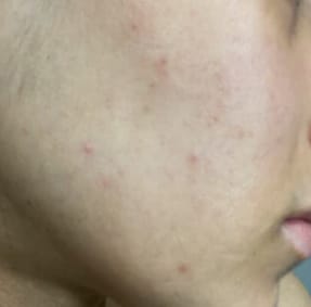 Customer photo review of Ready Set Glow - The Deliciously Effective Beauty Gummy