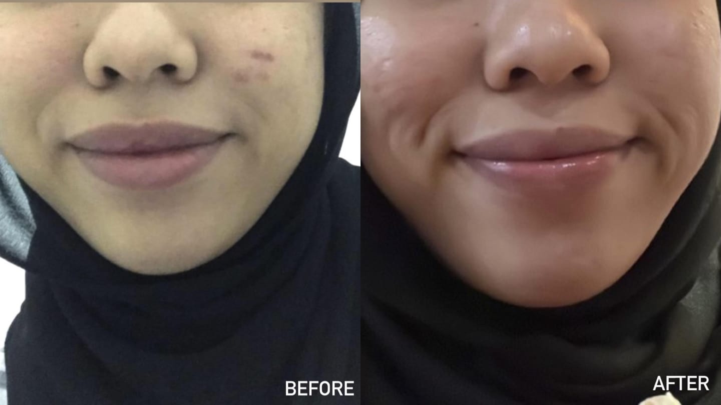 Customer photo review of Ready Set Glow - The Deliciously Effective Beauty Gummy