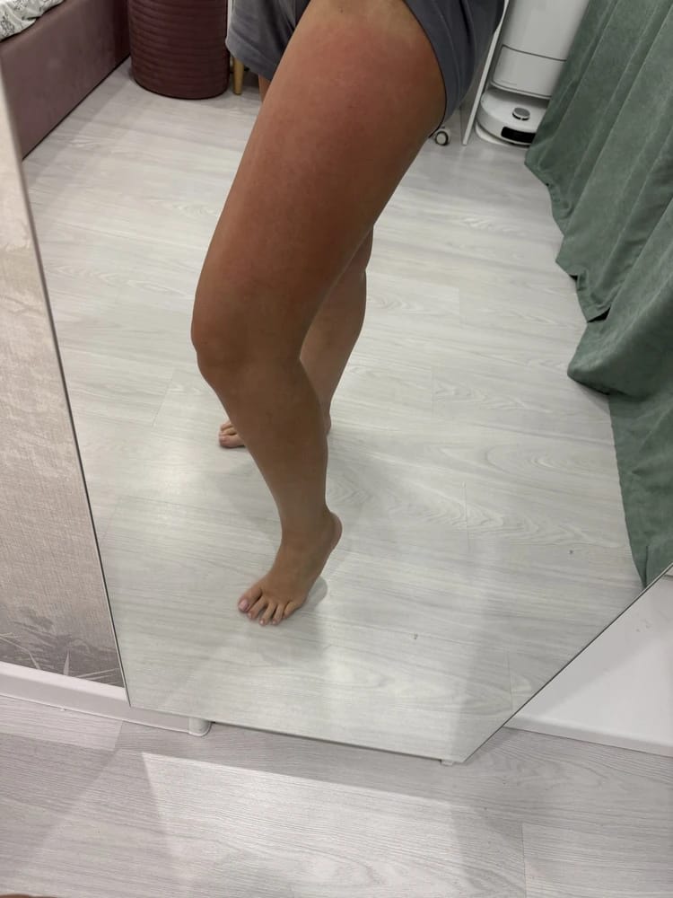Customer photo review of Revimus Anti-Cellulite Massager