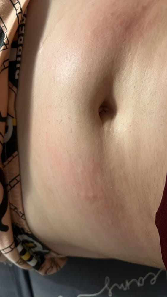 Customer photo review of Revimus Anti-Cellulite Massager