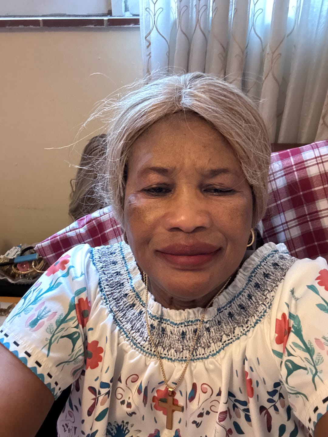 Customer photo review of Perfect Skin Tone Dark Spot Capsules