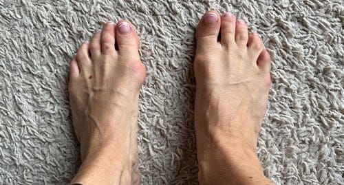 Customer photo review of Foot Medikal