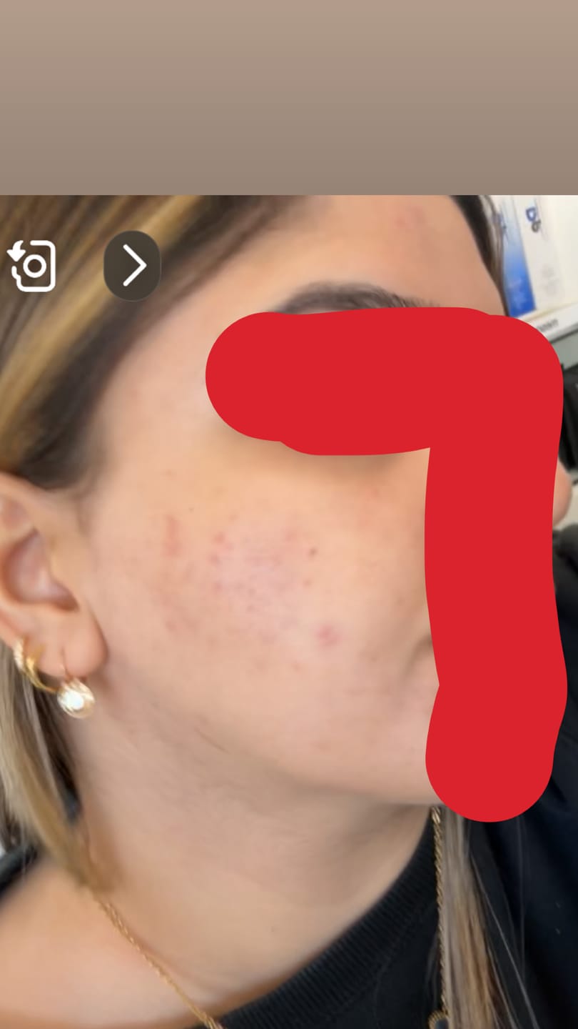 Customer photo review of CLIMAXX