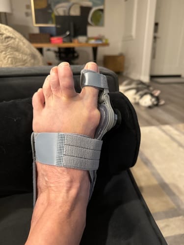 Customer photo review of Foot Medikal