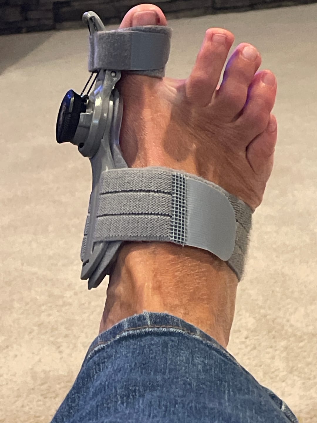 Customer photo review of Foot Medikal