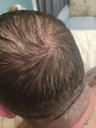 Customer photo review of NOEVA - 100% Pur Batana