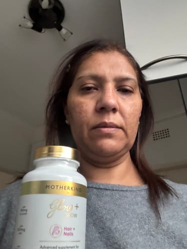 Customer photo review of Glow + Grow Hair Growth Collagen