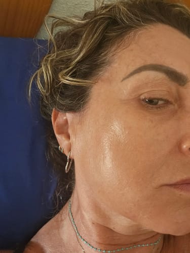 Customer photo review of Sérum de Exosomas Ultra Rejuvenecedor con Bioexosomas de Bakuchiol