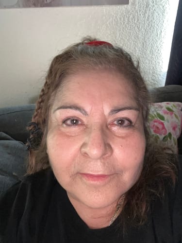 Customer photo review of Grass Fed Tallow & Honey Balm