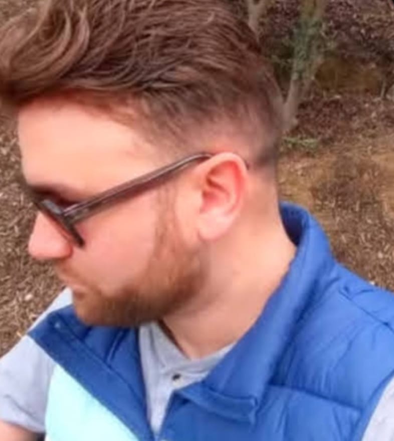 Customer photo review of HOLLYWOOD : Lace Hair System for Men With PU Perimeter and 1/2" Lace Front (100% Density)