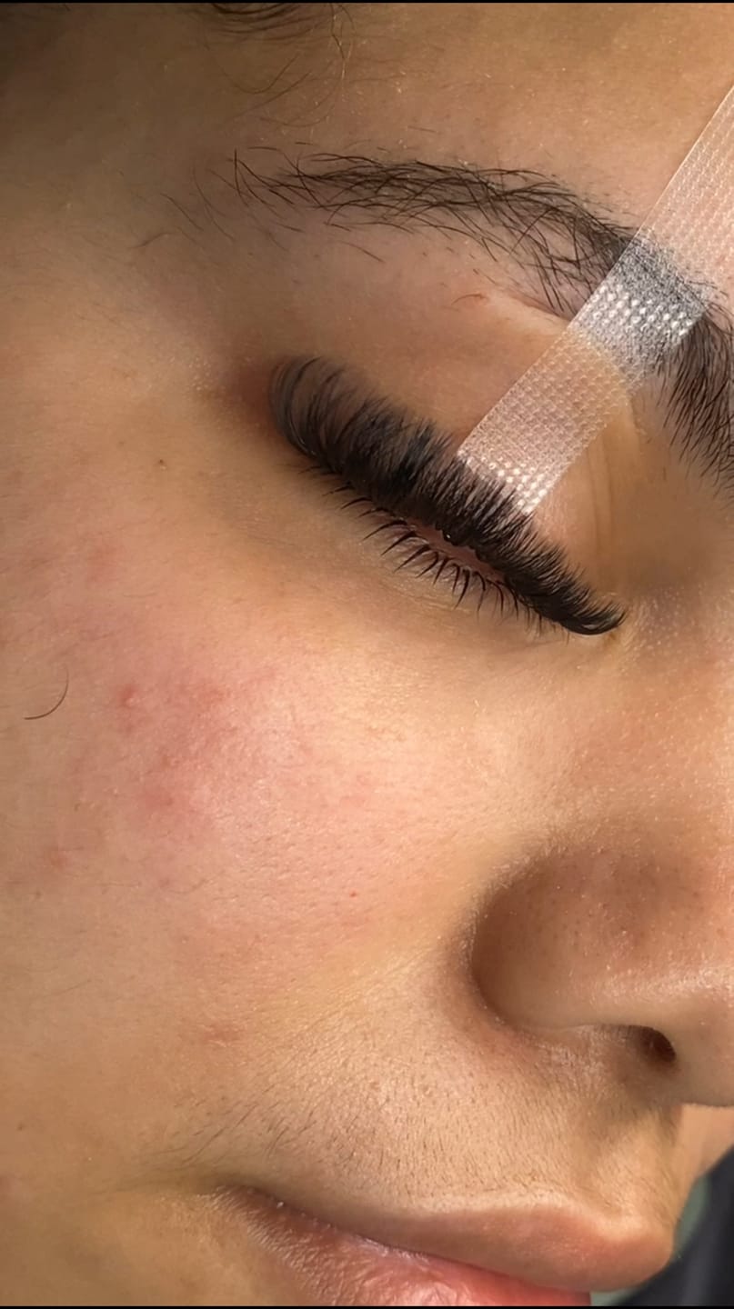 Customer photo review of Volume 5ml - Lash Extension Glue
