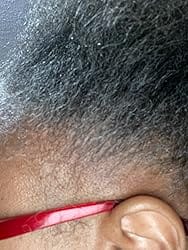 Customer photo review of NOEVA - 100% Pur Batana