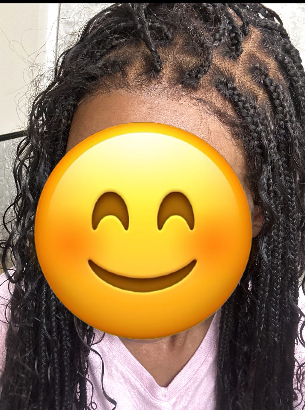 Customer photo review of The Complete All in One Wig Install Kit