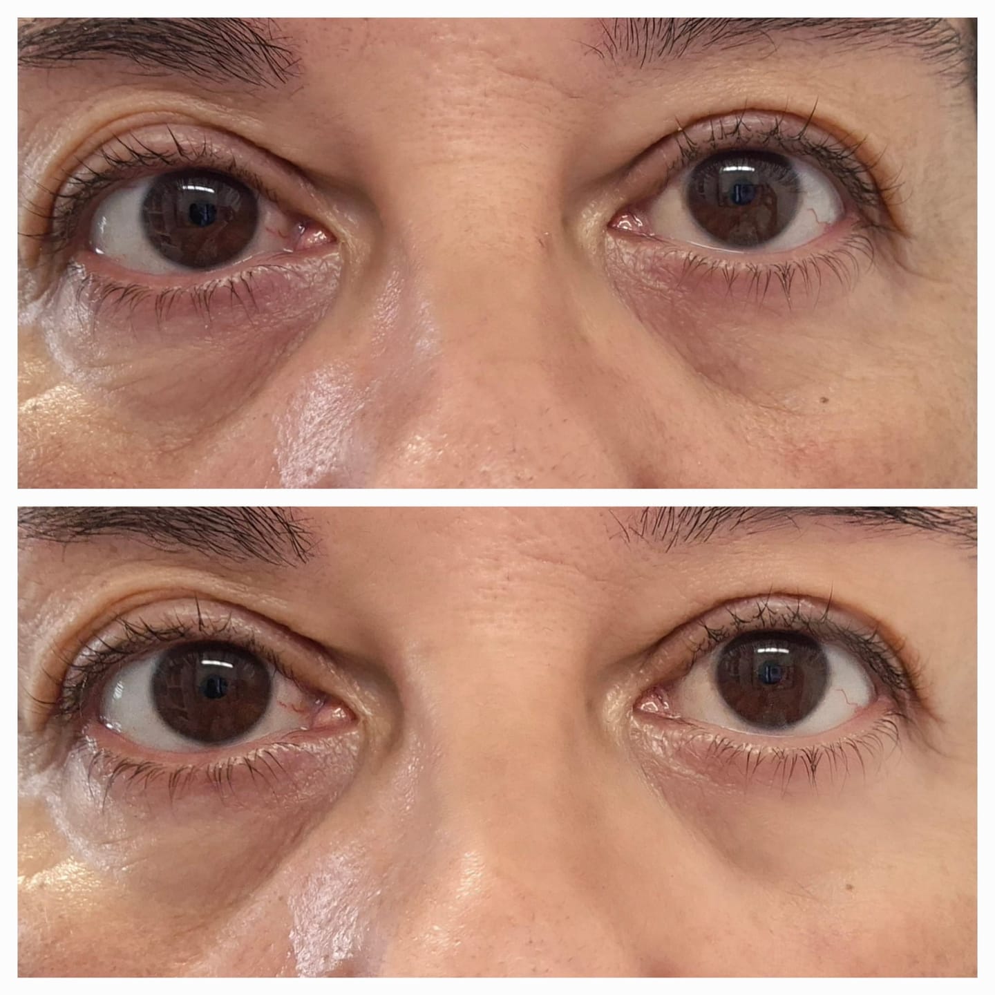 Customer photo review of Ecume - Patchs anti-cernes