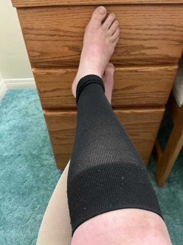 Customer photo review of YoU® Black Crop Leg Sleeves 20-30 mmHg