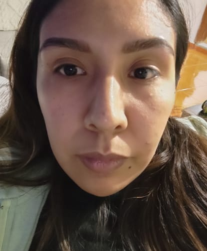 Customer photo review of Kit Piel Deslumbrante (47% OFF) - Limpiador + Tónico + Serum Vitamina C + Serum Niacinamida + Serum Ácido Glicólico + Serum Ácido Hialurónico + Contorno de Ojos