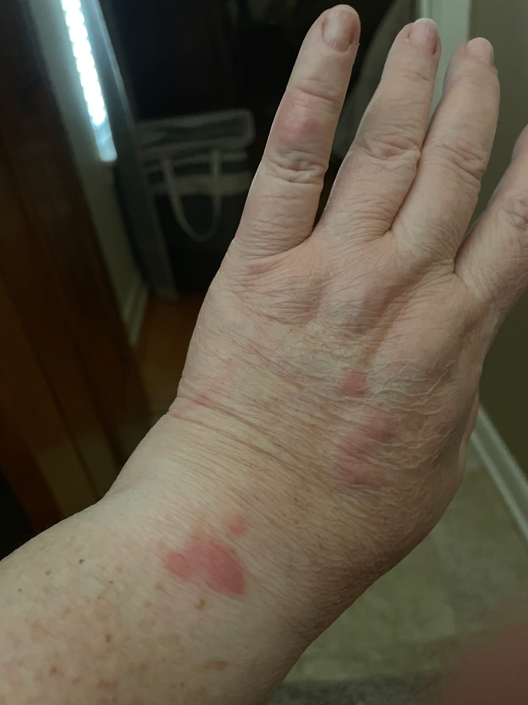 Customer photo review of Organic Calendula Salve
