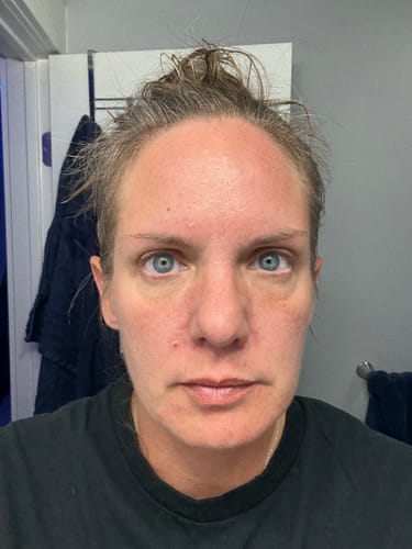 Customer photo review of Grass Fed Tallow & Honey Balm