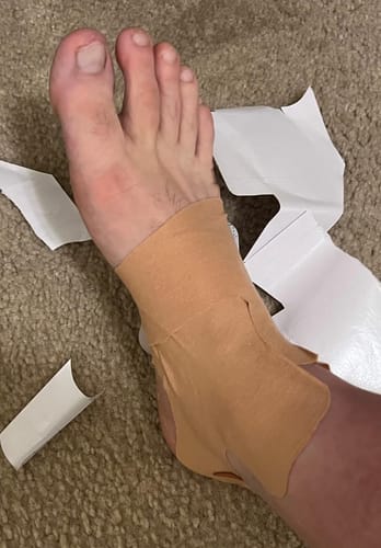 Kundenbewertung mit Foto zu TAPEX™ - Fußgelenk