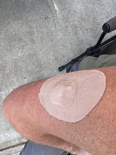 Customer photo review of Skin Tac Adhesive Barrier Wipes – Skin Grip