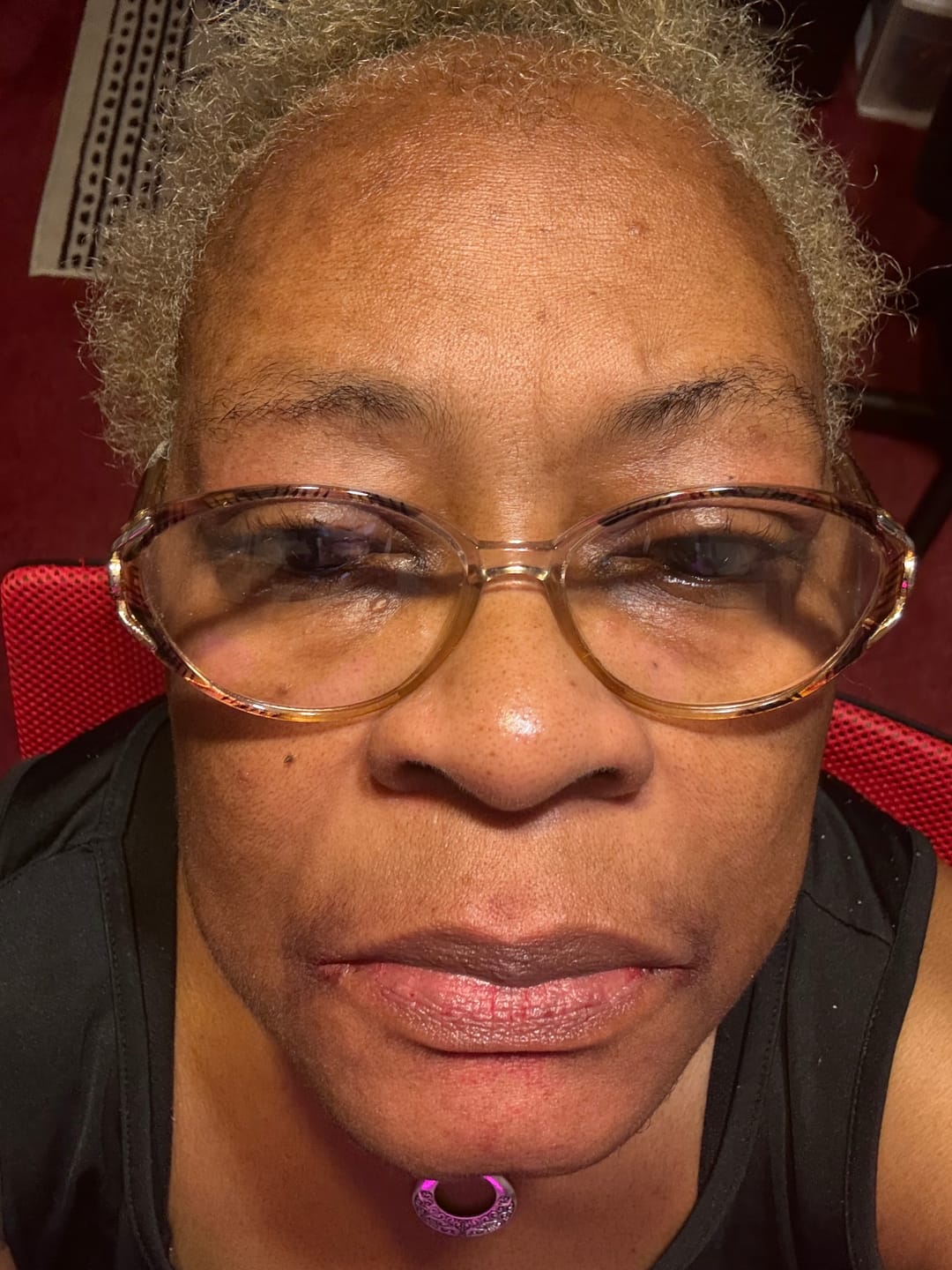 Customer photo review of Carotone Trio Black Spot Corrector Kit 4.4 oz