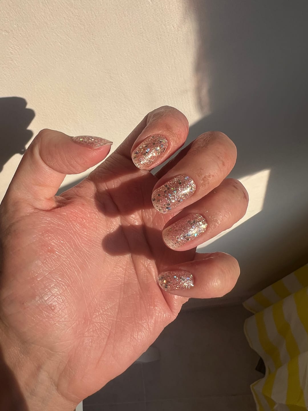 Customer photo review of N Sparkle Glam Jel Tırnak 30 Adet, 2 Kullanım