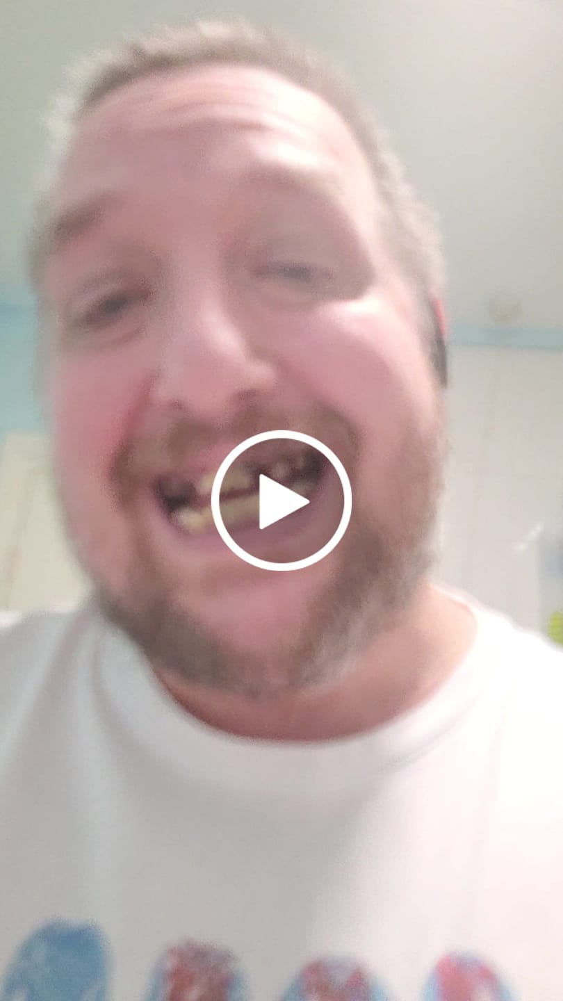 Customer video review of Click-in Veneers 4.0