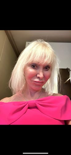 Customer photo review of Grass Fed Tallow & Honey Balm